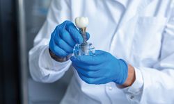 Dentoniks İle Bursa İmplant Tedavisi Nasıl Bir Deneyim Sunar?