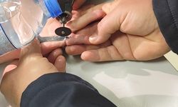 Parmağına sıkışan yüzüğü itfaiye çıkardı