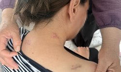 Tarsus’ta Dehşet: 3 Çocuk Annesi Havva Ç. 17 Bıçak Darbesiyle Hayatta Kaldı