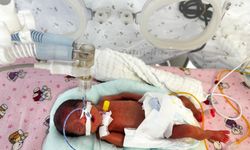 650 gram doğan 'Leyloş bebek' hayata tutundu