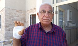 Komşusunun ısırdığı parmağı ampute edildi