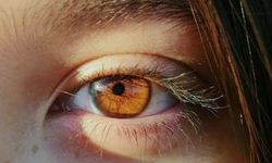 Yurt Dışından Gelen Hastalar İçin Laser Eye Color Change Turkey