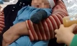 Vücuduna kene tutunan kadın, hayatını kaybetti / Fotoğraf
