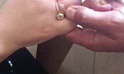 Parmaklarına sıkışan yüzükleri itfaiye çıkardı