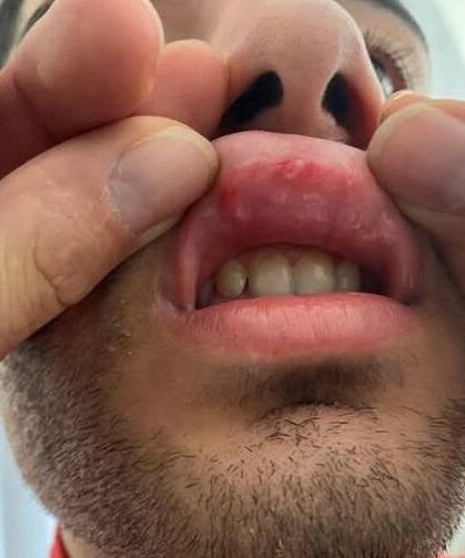 Mersin'de amatör maç öncesi çıkan kavga güvenlik kamerasında