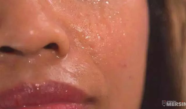 Sıcaklarda Yüzün Mü Akıyor? Bu İki Malzeme ile Terlemeye Veda Et!