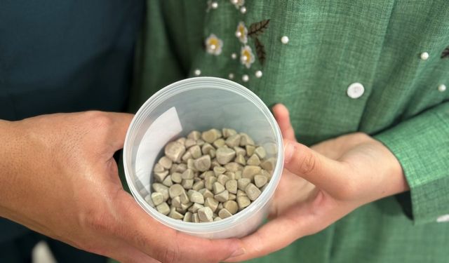 Fatma Nur’un Vücudundan 287 Taş Çıkarıldı: Nadir Görülen Bir Vaka