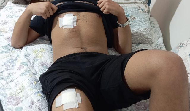 Eski sevgilisiyle yazıştığı akranı ve onun arkadaşları tarafından dövülüp, bıçaklandı