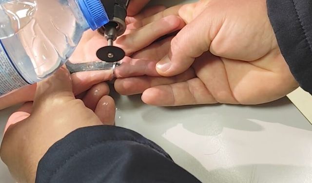 Parmağına sıkışan yüzüğü itfaiye çıkardı