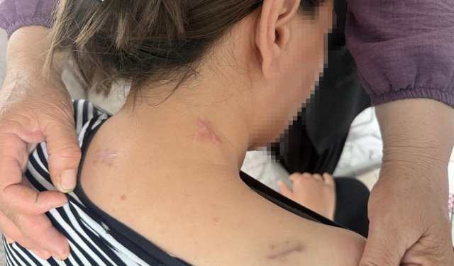 Tarsus’ta Dehşet: 3 Çocuk Annesi Havva Ç. 17 Bıçak Darbesiyle Hayatta Kaldı