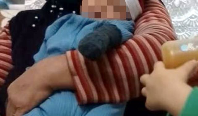 Vücuduna kene tutunan kadın, hayatını kaybetti / Fotoğraf